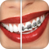 Brace Face - Black Frog Industries, LLC